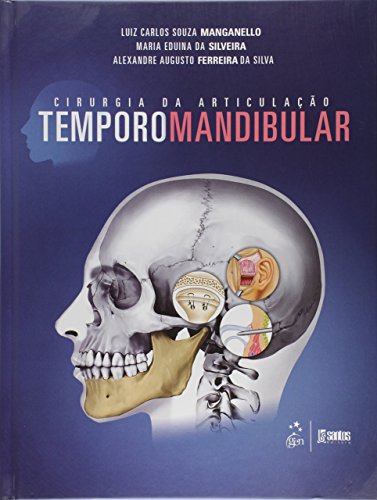 Ler Cirurgia da Articulação Temporomandibular, do autor Luiz Carlos Souza Manganello; Alexandre Augusto Ferreira da Silva; Maria Eduina da Silveira
